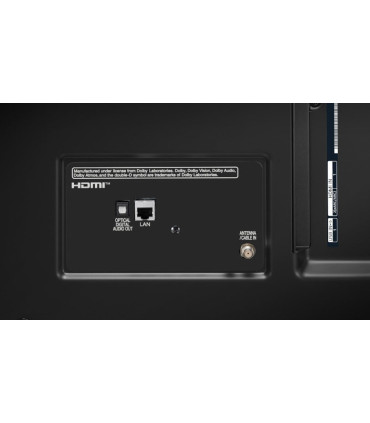 تلویزیون 75 اینچ ال جی 4K UHD مدل 75UP7070 2021